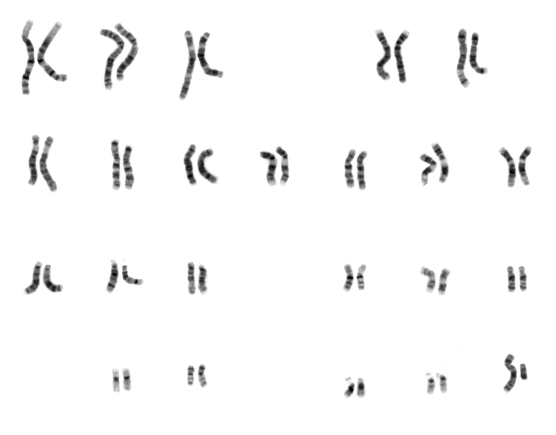 Grayscale human karyotype arranging chromosomes into homologous pairs